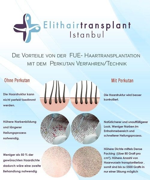 Perkutan Technik Haartransplantation bei Dr. Balwi