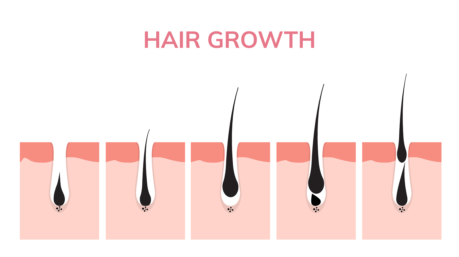 Zyklus des Haarwachstums