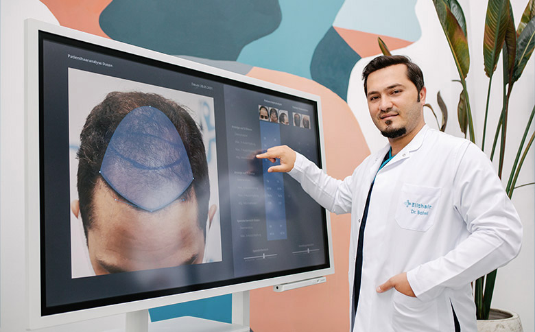 Dr Balwi zeigt auf den Bildschirm der Haaranalyse für die Haartransplantation